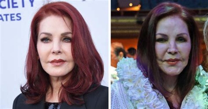 Ben Affleck Plastic Surgery ‘Nightmare’: Desperate Attempt Look Youthful?