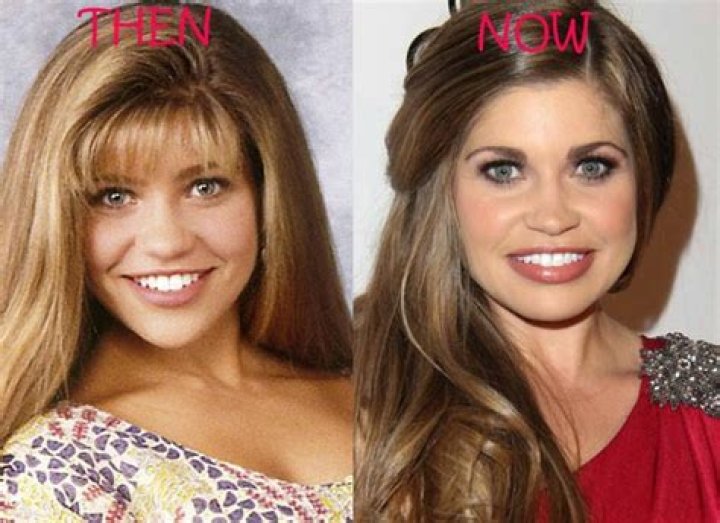 Danielle Fishel Plastic Surgery Before and After