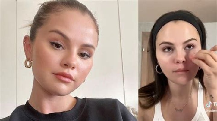 Maladie Selena Gomez