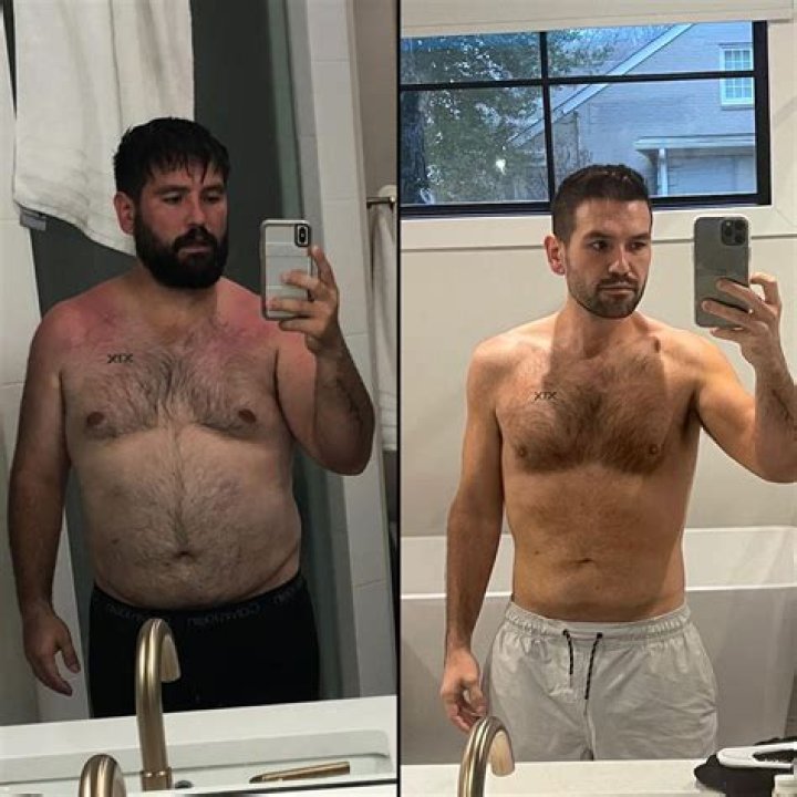 
Matt Patricia Weight Loss & Diet: Before And After Photo	