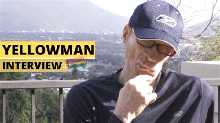 Yellowman Maladie 